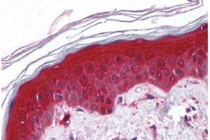 Human Skin (formalin-fixed, paraffin-embedded) stained with PYCARD antibody ABIN213971 at 5 ug/ml followed by biotinylated goat anti-rabbit IgG secondary antibody ABIN481713, alkaline phosphatase-streptavidin and chromogen. (PYCARD antibody  (AA 182-195))
