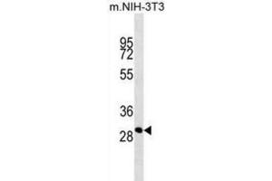 Western Blotting (WB) image for anti-THAP Domain Containing 11 (THAP11) antibody (ABIN2914323) (THAP11 antibody)