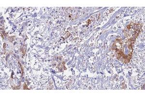Immunohistochemistry (IHC) image for anti-Interleukin 6 Signal Transducer (Gp130, Oncostatin M Receptor) (IL6ST) (C-Term) antibody (ABIN6260571)