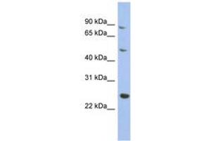 Image no. 1 for anti-Matrilin 3 (MATN3) (AA 215-264) antibody (ABIN6744056)