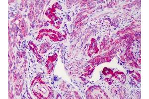 Human Uterus: Formalin-Fixed, Paraffin-Embedded (FFPE) (SLC5A3 antibody)