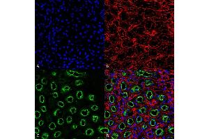 Immunohistochemistry analysis using Rabbit Anti-NKCC2 Polyclonal Antibody (ABIN2486331). (SLC12A1 antibody  (AA 33-55) (PE))
