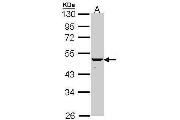 Keratin 34 Antikörper