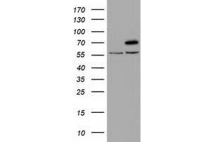 Western Blotting (WB) image for anti-Tripartite Motif Containing 2 (TRIM2) (AA 1-100), (AA 645-744) antibody (ABIN1490545) (TRIM2 antibody  (AA 1-100, AA 645-744))