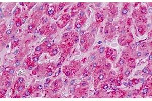 Human Liver: Formalin-Fixed, Paraffin-Embedded (FFPE) (RPL7 antibody  (AA 199-248))