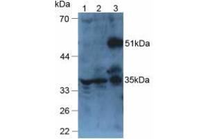 Figure. (ANGPTL6 antibody  (AA 238-457))