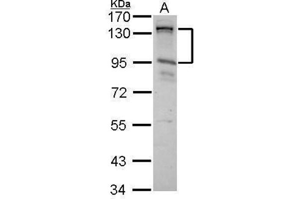 CIZ1 antibody