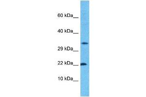 Host:  Rabbit  Target Name:  CROC4  Sample Type:  ACHN Whole Cell lysates  Antibody Dilution:  1. (C1orf61 antibody  (N-Term))