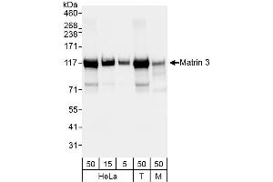 Western Blotting (WB) image for anti-Matrin 3 (MATR3) (C-Term) antibody (ABIN7455225) (MATR3 antibody  (C-Term))