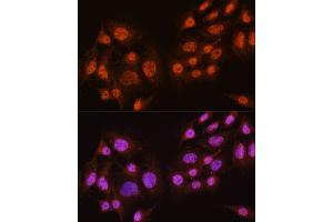 Immunofluorescence analysis of C6 cells using // antibody (ABIN7265520) at dilution of 1:100. (AKT 1/2/3 antibody)