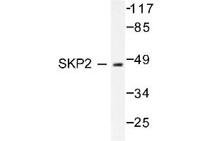 Image no. 1 for anti-S-Phase Kinase-Associated Protein 2 (SKP2) antibody (ABIN271816) (SKP2 antibody)