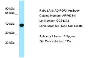 Western Blotting (WB) image for anti-Adiponectin Receptor 1 (ADIPOR1) (C-Term) antibody (ABIN2789457) (Adiponectin Receptor 1 antibody  (C-Term))