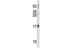 ISG15 antibody western blot analysis in 293 lysate (ISG15 antibody  (AA 31-61))