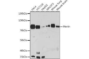 Western blot analysis of extracts of various cell lines, using Menin Rabbit mAb (ABIN7268697) at 1:1000 dilution. (Menin antibody)