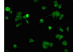 Immunofluorescent analysis of MCF-7 cells using ABIN7146085 at dilution of 1: 100 and Alexa Fluor 488-congugated AffiniPure Goat Anti-Rabbit IgG(H+L) (CD27 antibody  (AA 229-312))