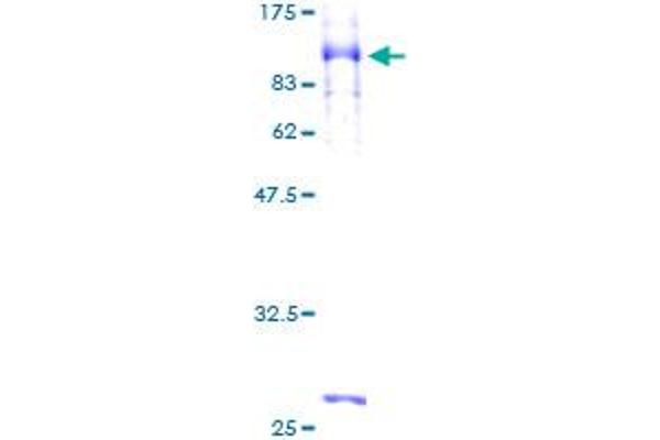 SOCS6 Protein (AA 1-535) (GST tag)