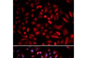 Immunofluorescence analysis of U2OS cells using PRKACB Polyclonal Antibody (PRKACB antibody)