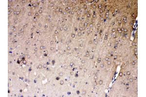 IHC analysis of NDRG3 using anti- NDRG3 antibody . (NDRG3 antibody  (AA 181-239))
