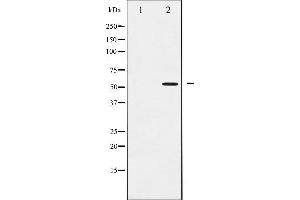 Western Blotting (WB) image for anti-SMAD, Mothers Against DPP Homolog 2 (SMAD2) (pSer467) antibody (ABIN6256347)