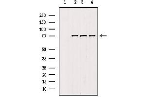 Western blot analysis of extracts from various samples, using RNF156 antibody.