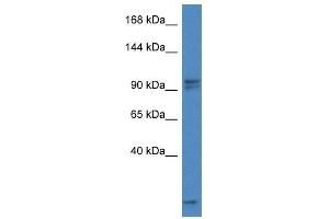 Western Blot showing Aak1 antibody used at a concentration of 1. (AAK1 antibody  (C-Term))