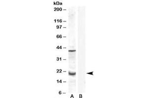Western blot testing of human prostate lysate with GPX7 antibody at 0. (Glutathione Peroxidase 7 antibody)