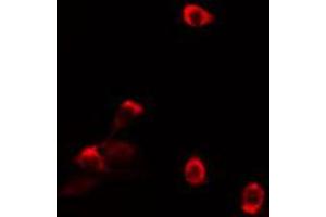 ABIN6274125 staining HT29 cells by IF/ICC. (TAF5L antibody  (Internal Region))