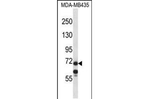 Western blot analysis in MDA-MB435 cell line lysates (35ug/lane). (MID1 antibody  (C-Term))