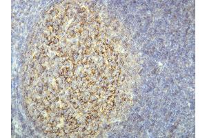 Immunohistochemistry (IHC) image for anti-Complement Component (3d/Epstein Barr Virus) Receptor 2 (CR2) (AA 1015-1032), (C-Term) antibody (ABIN7598791)