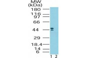 Image no. 1 for anti-Corticotropin Releasing Hormone Receptor 2 (CRHR2) (AA 75-125) antibody (ABIN960850) (CRHR2 antibody  (AA 75-125))