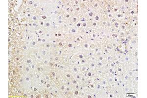 Formalin-fixed and paraffin embedded mouse liver labeled with Anti-DNTT Polyclonal Antibody, Unconjugated (ABIN681973) at 1:200 followed by conjugation to the secondary antibody and DAB staining (TdT antibody  (AA 351-450))