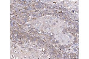 IHC analysis of TTC11/FIS1 using anti-TTC11/FIS1 antibody (ABIN7600321).