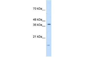WB Suggested Anti-TFB2M Antibody Titration:  5. (TFB2M antibody  (C-Term))