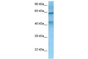 WB Suggested Anti-TIMD4 Antibody Titration: 1. (TIMD4 antibody  (N-Term))