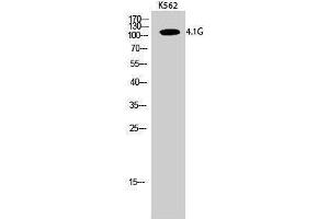 Western Blotting (WB) image for anti-erythrocyte Membrane Protein Band 4.1-Like 2 (EPB41L2) (Internal Region) antibody (ABIN3173586) (EPB41L2 antibody  (Internal Region))