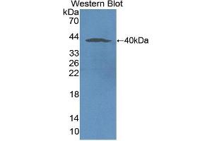 Detection of Recombinant NOX5, Human using Polyclonal Antibody to Nicotinamide Adenine Dinucleotide Phosphate Oxidase 5 (NOX5) (NOX5 antibody  (AA 456-765))