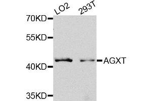 Western blot analysis of extracts of LO2 and 293T cells, using AGXT antibody. (AGXT antibody)