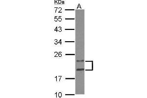 WB Image Sample (30 ug of whole cell lysate) A: HeLa 12% SDS PAGE antibody diluted at 1:1000 (PYCARD antibody)