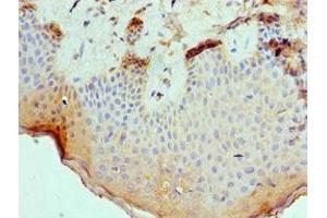 Immunohistochemistry of paraffin-embedded human skin tissue using ABIN7168694 at dilution of 1:100 (SLURP1 antibody  (AA 1-103))