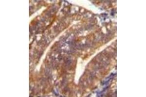 Formalin fixed and paraffin embedded human uterus tissue reacted with Periostin Antibody (C-term) followed by peroxidase conjugation of the secondary antibody and DAB staining. (Periostin antibody  (C-Term))