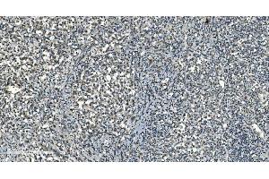 IHC analysis of LSM8 using anti-LSM8 antibody (ABIN7599579).