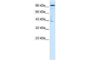 WB Suggested Anti-ZA20D1 Antibody Titration:  1. (OTUD7B antibody  (Middle Region))