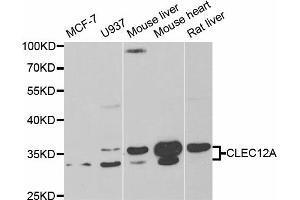 Western blot analysis of extracts of various cell lines, using CLEC12A antibody (ABIN5973681) at 1/1000 dilution.
