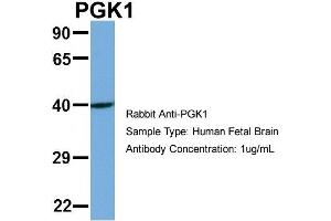 Host: Rabbit Target Name: PGK1 Sample Type: Human Fetal Brain Antibody Dilution: 1. (PGK1 antibody  (N-Term))