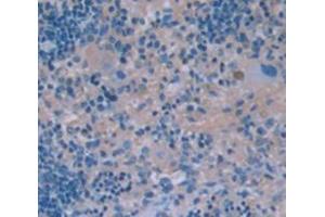 Figure. (S100A9 antibody  (AA 1-113))