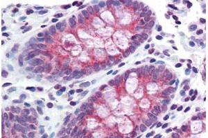 Colon, Human: Formalin-Fixed, Paraffin-Embedded (FFPE) (TMPRSS4 antibody  (Internal Region))