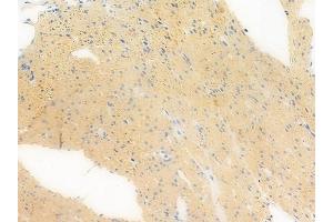 ABIN6258312 and ABIN6273385 at 1/100 staining human normal colon tissue by IHC-P. (RFPL1 antibody  (Internal Region))