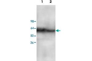Western blot analysis of Jurkat (Lane 1) and MCF-7 (Lane 2) cell lysate with CARD10 polyclonal antibody  at 1 : 200 dilution. (CARD10 antibody  (C-Term))