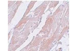 Immunohistochemistry of CCDC47 in mouse heart tissue with CCDC47 antibody at 5 μg/ml. (CCDC47 antibody  (C-Term))