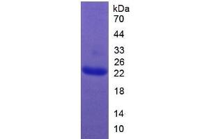 SDS-PAGE of Protein Standard from the Kit (Highly purified E. (Growth Hormone 1 CLIA Kit)